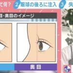 レス2番の画像1