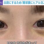 レス1番の画像2